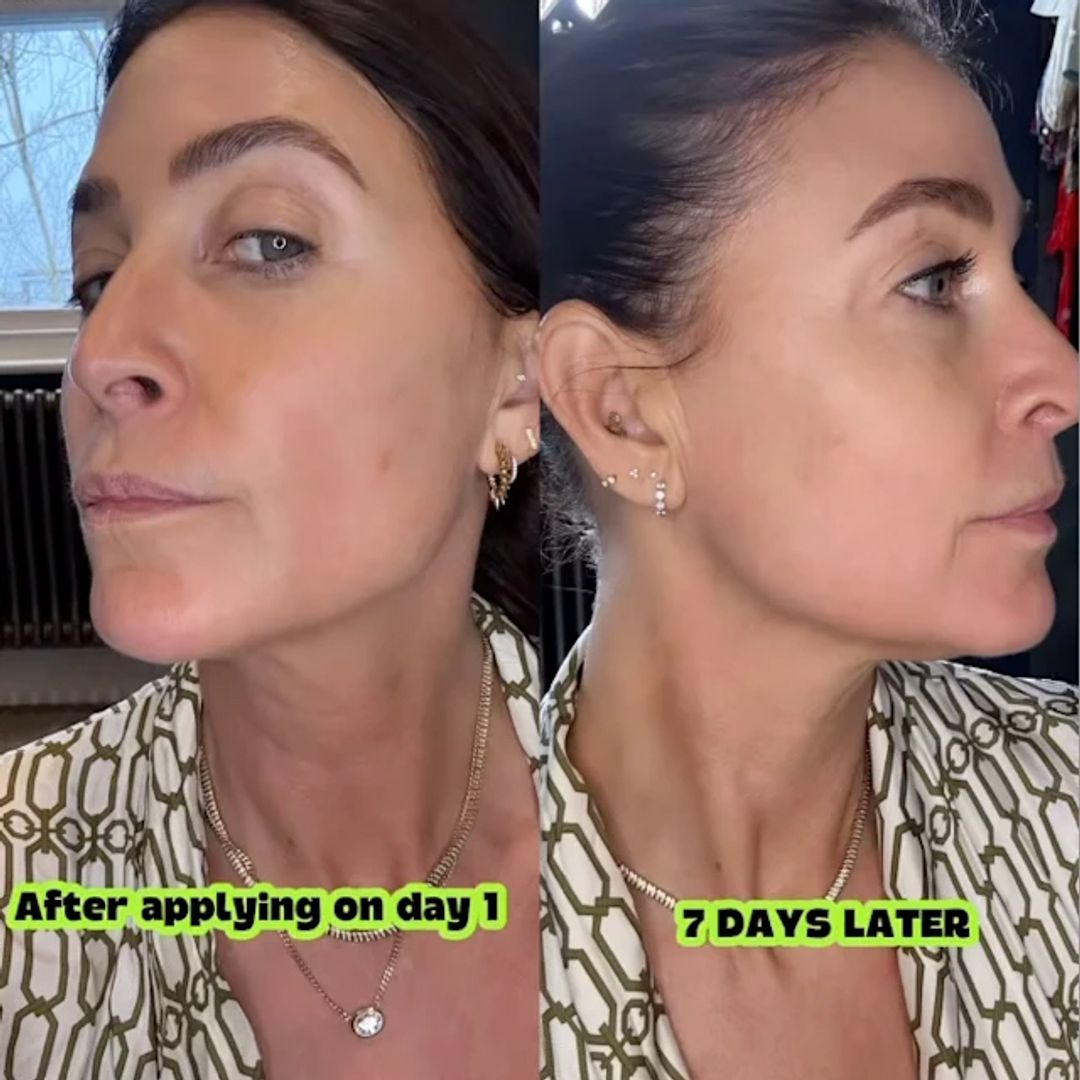 Lisa Snowdon hails this £16 neck serum for tightening saggy skin - and it's on sale